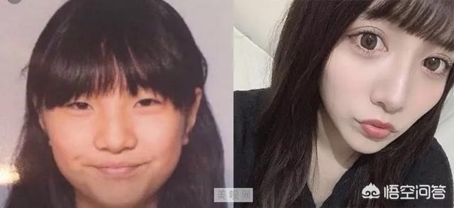 罗霈颖整容对比照:如何看待私生整容后追到爱豆这件事？