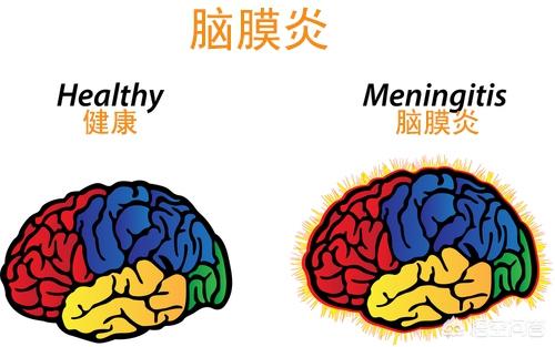 云南发生鼠疫25个:中华人民共和国成立至今我国共发生过几次疫情对生活有什么影响