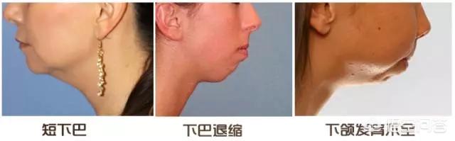 娜娜娜扎侧脸对比:正脸还可以，侧脸好丑是一种怎样的体验？