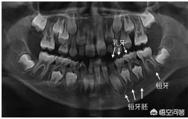 小孩先换下牙预兆什么,小孩换牙时间是什么时间？