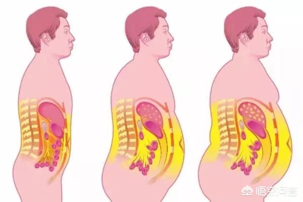 如何有效降低内脏脂肪含量，如何才能知道“内脏脂肪”多不多，如何减内脏脂肪
