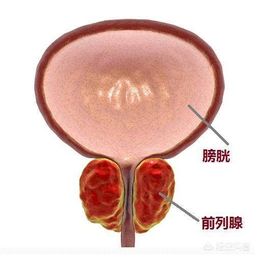男性健康日活动总结:男性如何守护前列腺健康？