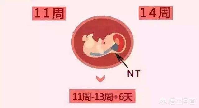 nt的正常值范围多少啊，NT值0.35mm一定代表孩子有问题吗