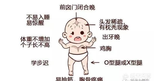 活动性佝偻病症状:先天性佝偻病的宝宝有什么症状？