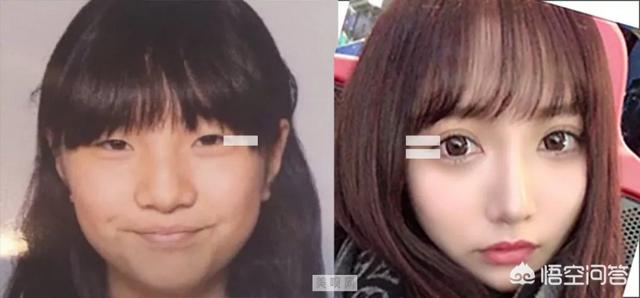 罗霈颖整容对比照:如何看待私生整容后追到爱豆这件事？