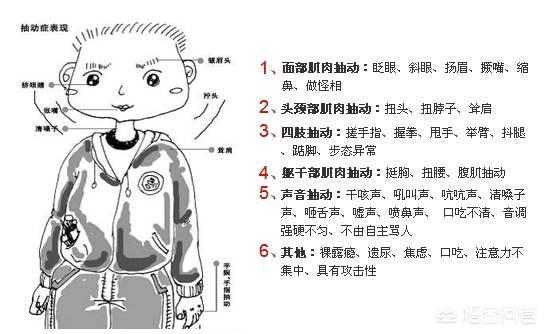 小孩下眼睑抽搐的原因:下眼睑一直抽搐的原因 小儿抽动是什么原因导致的？应该注意什么？