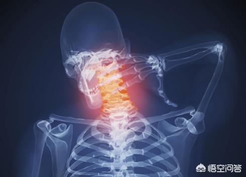 颈部牵引能使膨出恢复吗:劲椎膨出如何快速消除疼痛？