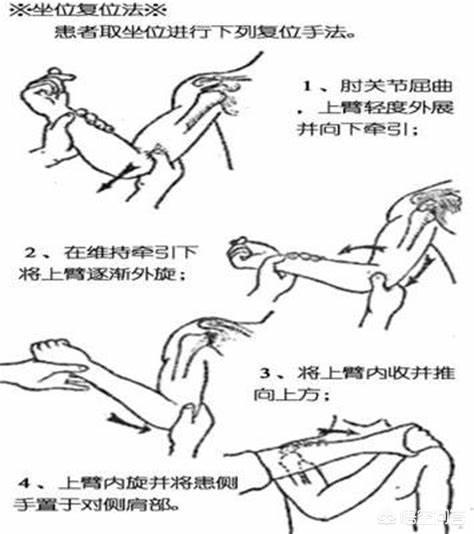 头条问答 - 桡骨小头半脱位耽误治疗后果严重吗?(1个回答)