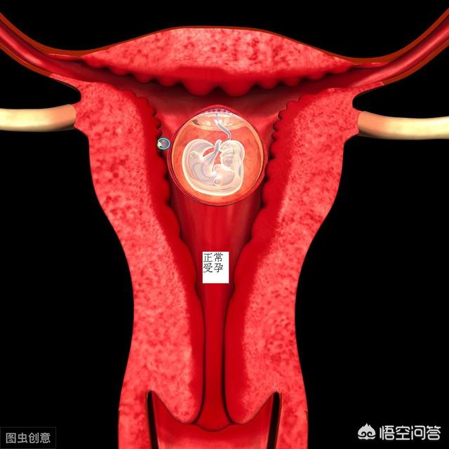 女孩宫外孕,是男人的错吗？
