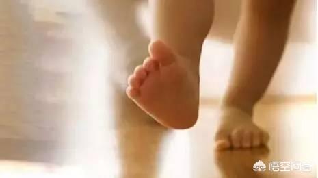 幼儿外八字:8个月大的小孩，走路外八字怎么纠正？