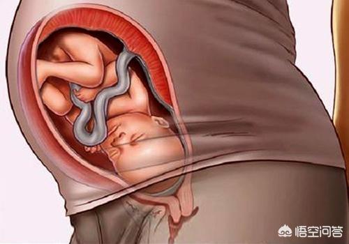 小宝宝在妈妈肚里倒着不难受吗，婴儿在妈妈肚子里脑袋朝下为什么不会脑充血？