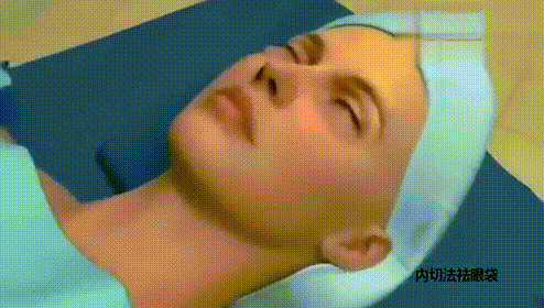 眼袋该怎么办(突然发现有眼袋了怎么办)