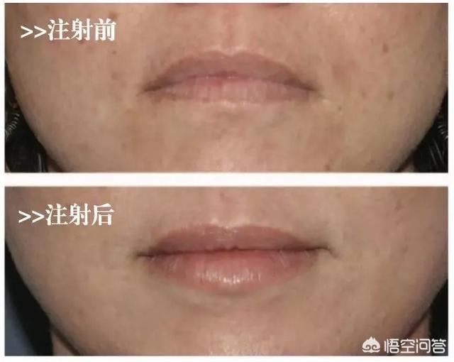 颧骨位置图片,什么长相的女生会看起来显得凶？