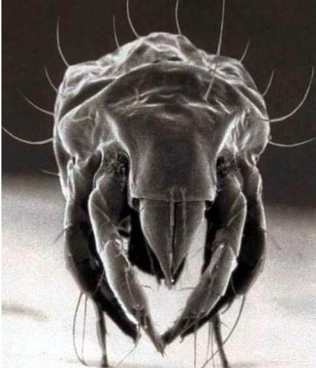 头条问答 - 你知道"剪发虫"是什么吗?会对头皮有什么伤害?(1个回答)