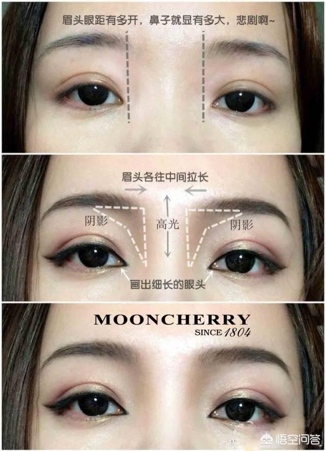 塌鼻梁图片:鼻梁塌、鼻翼宽，塌鼻人如何自救？