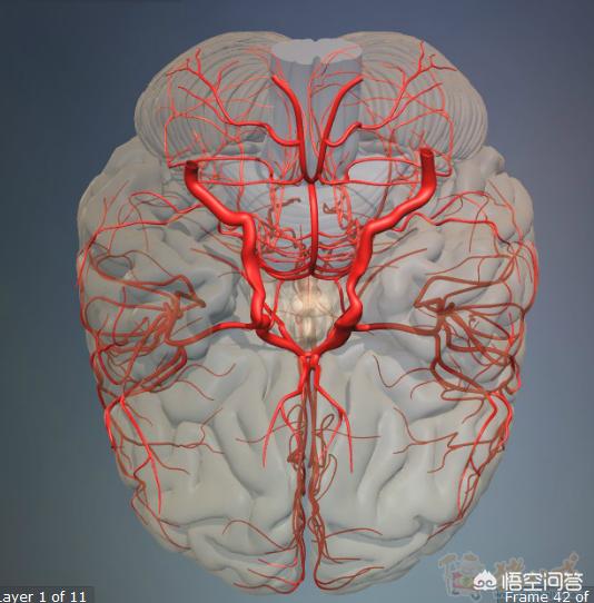 脑血栓能活多久，脑栓塞病人能活多久应该如何有效治疗