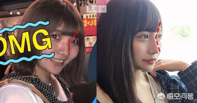罗霈颖整容对比照:如何看待私生整容后追到爱豆这件事？