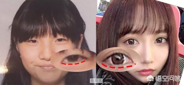 罗霈颖整容对比照:如何看待私生整容后追到爱豆这件事？