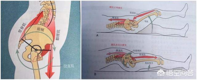 走路能够改善骨盆前倾吗？