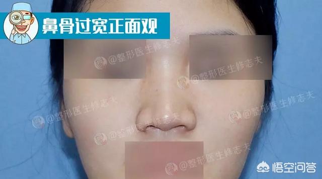 娜娜娜扎侧脸对比:为什么有人侧颜比正脸好看多了？