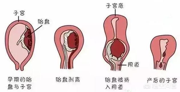 顺产后恶露多久干净:产后恶露多久排干净？剖腹产和顺产后恶露排出有何区别？