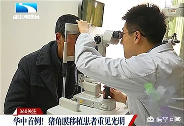 猪皮移植:把猪器官移植到人体，能成为现实吗？