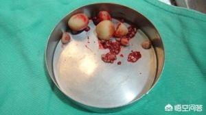 膀胱结石症状:狗狗膀胱结石打完结石还会长吗吃药能打干净不？ 膀胱结石症状有哪些