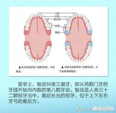 微创拔牙术前准备:拔牙的前后注意事项为哪些？