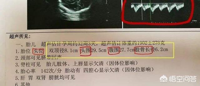 为什么有些孕妇B超预估胎龄会显示小1周或2周？这是不是会让宝宝推迟出生？