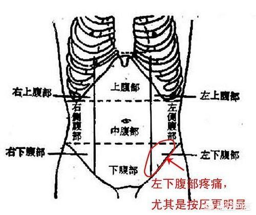 头条问答 左下腹疼痛是怎么回事 长腿医生的回答 0赞