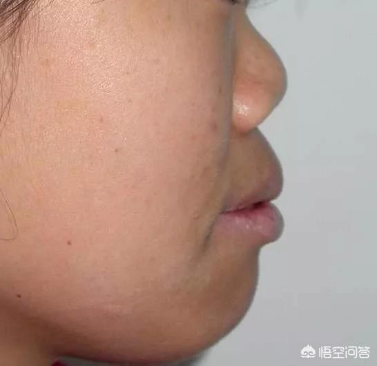 娜娜娜扎侧脸对比:正脸还可以，侧脸好丑是一种怎样的体验？
