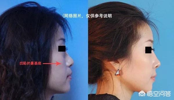 娜娜娜扎侧脸对比:正脸还可以，侧脸好丑是一种怎样的体验？