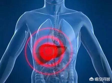 肝癌不痛不痒,出现2痣3少,要及时检查,别拖延！你知道是什么吗？