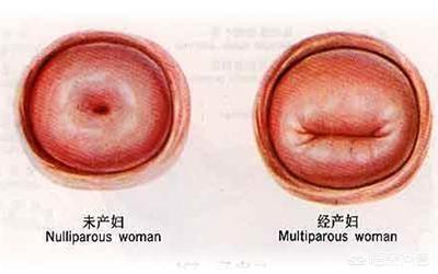 头条问答 - 宫颈口太小会影响受孕吗?(60个回答)