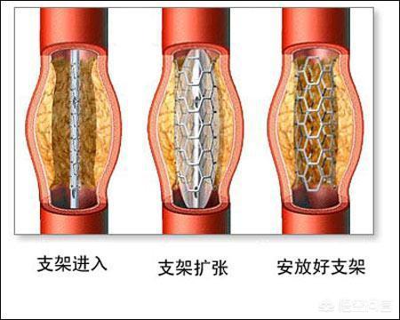 橘猫吃药视频:养了8年的猫，治病要花10万，你会救吗？ 橘猫吃药视频大全