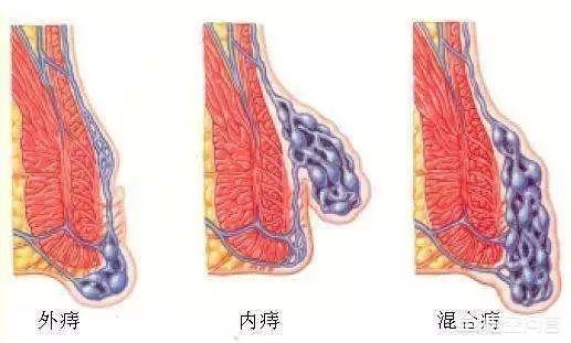 金琥消痔膏多少钱:你看病时花过冤枉钱吗？有哪些经历？