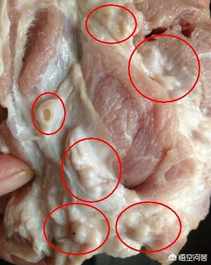 肠道寄生虫病未特指:儿童需要定期打蛔虫吗？怎么打？