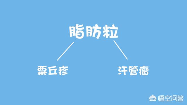脂肪粒怎么消除在眼睛旁边的:眼周脂肪粒是怎么形成的？如何摆脱眼周脂肪粒的困扰？