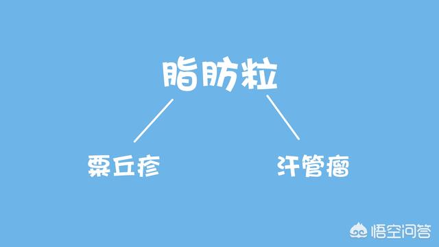 眼睛周围长脂肪粒怎么办:眼睛周围长脂肪粒怎么去掉