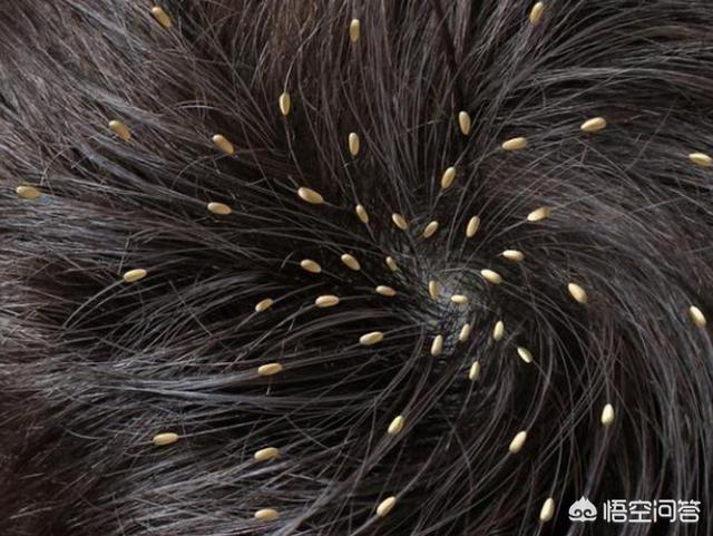 怎么识别毛囊虫:螨虫痘是什么？螨虫痘与普通青春痘的区别在哪里呢？