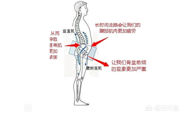 纠正骨盆前倾最佳方法,骨盆前倾能靠墙站纠正吗？