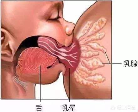 乳汁分泌会疼吗:产妇喂奶期间乳房疼，怎么办？
