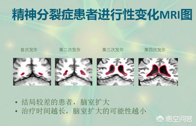 怎么样造成的精神分裂症,精神分裂症与睡眠有什么关系？