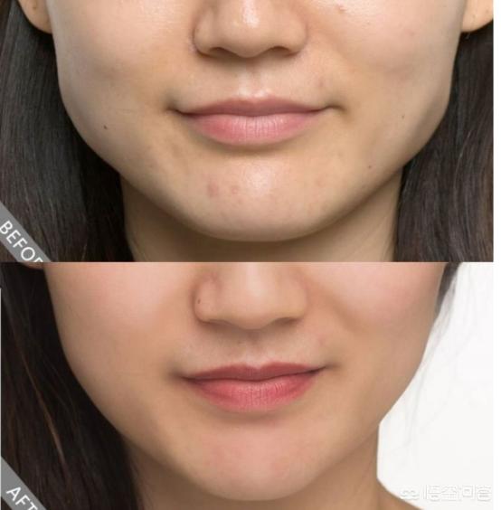 脸大的女生怎样才能显脸小