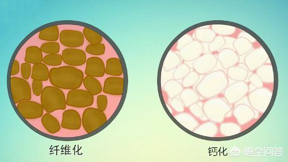 颞部填充,自体脂肪填充面部安全吗？