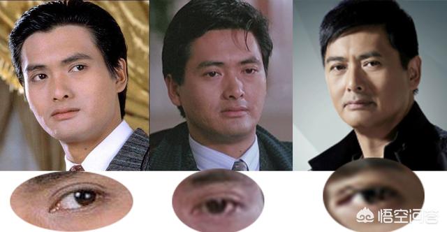 郑柔美整容前后:最早一批做双眼皮手术的人怎么样了？