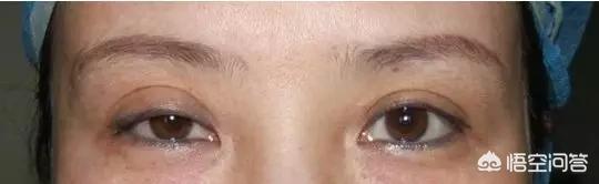 希思黎瞬间紧致眼膜:眼皮皮肤松弛下垂了怎么办？