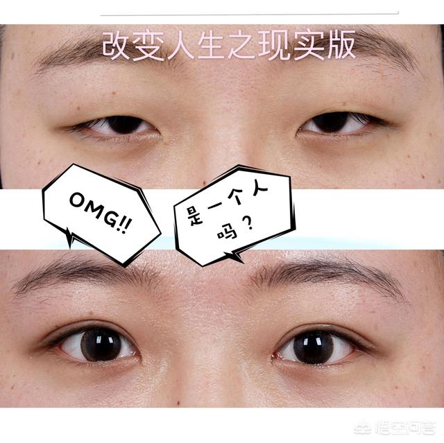 郑柔美整容前后:最早一批做双眼皮手术的人怎么样了？