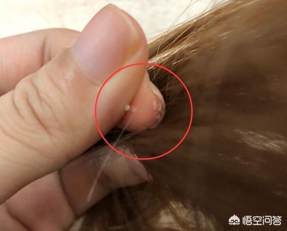 怎么识别毛囊虫:螨虫痘是什么？螨虫痘与普通青春痘的区别在哪里呢？
