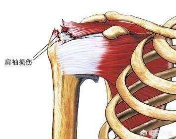 四柱哪一柱力量最大,瑜伽四柱支撑该如何发力？